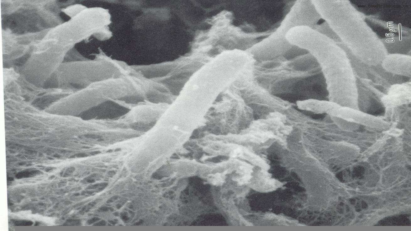 青島能源所實現(xiàn)100%光學純D-乳酸的生物合成