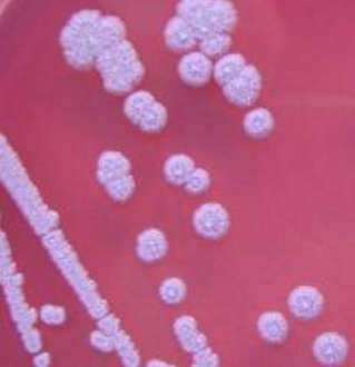 E264伯克氏菌屬的由來及特征介紹！-ATCC菌種中文官網(wǎng)