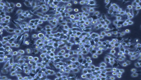 GT1-1 小鼠垂体瘤细胞的处理方法与培养步骤！