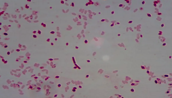 苏云金芽孢杆菌的作用机理与应用领域及使用方法！