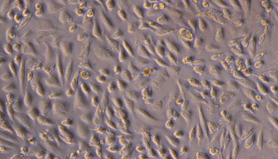 小鼠卵巢颗粒细胞的运输和保存及相关研究！