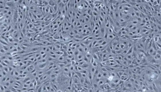 人肝窦内皮细胞LSEC的复苏与传代操作说明！