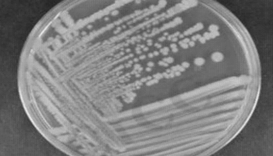 长双歧杆菌婴儿亚种的培养方法与使用范围！