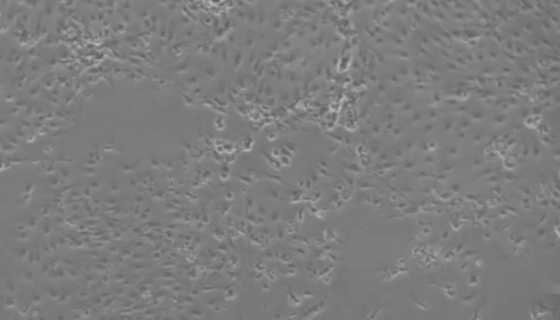 大鼠甲状腺滤泡上皮细胞的培养操作与应用！