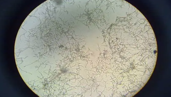 伴放线放线杆菌的形态特征与生长规律！