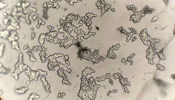 热带假丝酵母的生存环境及检查与培养方法！