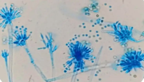 帚状曲霉的培养方法与注意事项及打管说明！