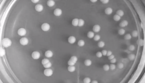 发酵毕赤酵母的特征与价值及注意事项！