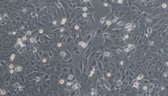 NCI-H292（人肺癌细胞(淋巴结转移)）