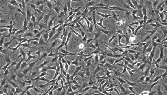 人星形胶质细胞的使用方法与注意事项！