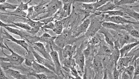 人椎间盘髓核细胞的质量检测与操作步骤！