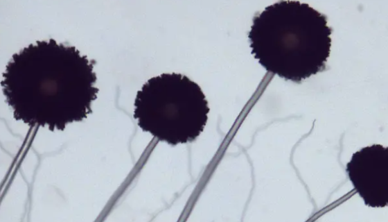 黑曲霉的形态特征与生态分布及经济用途！