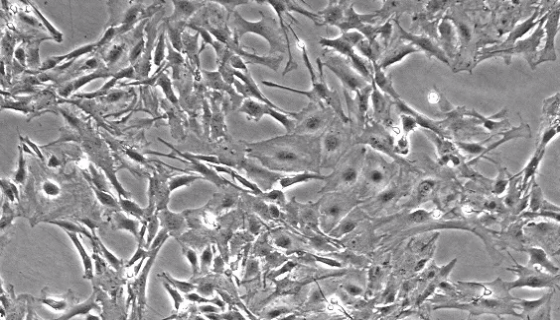 小鼠星形胶质细胞的处理方法与培养操作及注意事项！