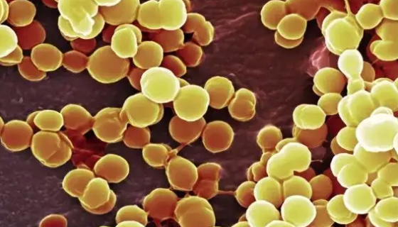 表皮葡萄球菌的生物学性状与微生物学检查！