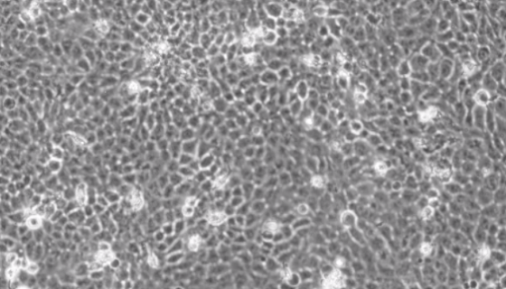 HB人口腔癌细胞收到后的处理方法与培养步骤！