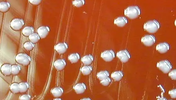 洋葱伯克霍尔德菌的培养方法及使用范围！