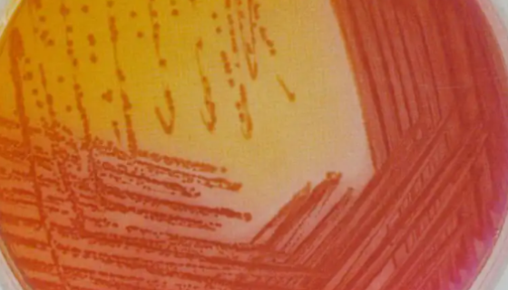 产气肠杆菌的菌体形态与生化反应及临床意义！