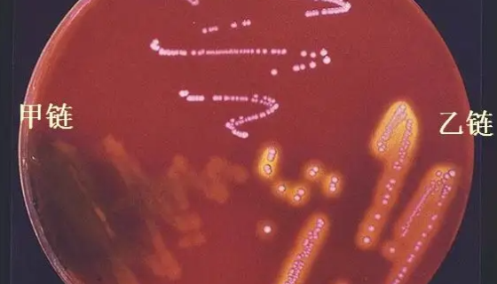 乙型溶血性链球菌的病理分类及检测方法与步骤！