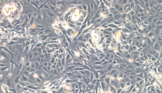 大鼠脑微血管内皮细胞的体外培养及相关研究！