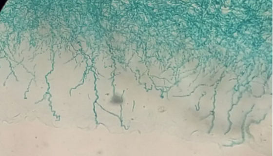 青霉属的培养条件与注意事项及打管说明！