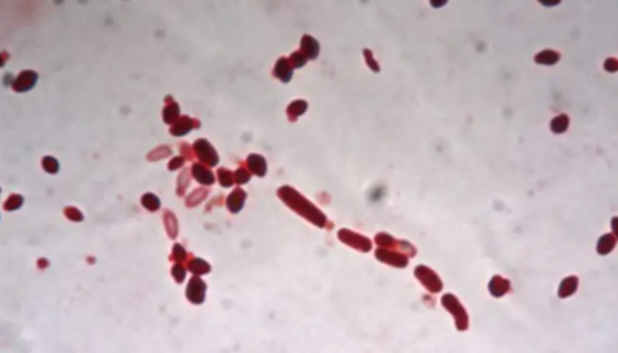 无色杆菌属的培养条件与注意事项及保藏方法！