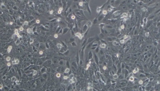 NCI-H1437人肺癌细胞的处理方法与培养步骤！