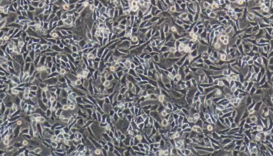 MLE-12小鼠肺上皮细胞的培养操作与应用！