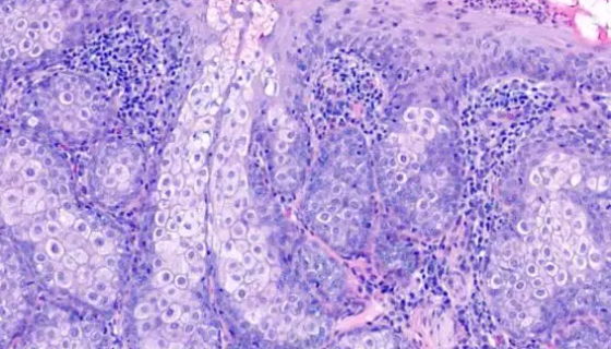 人皮脂腺细胞SZ95的培养步骤与注意事项！