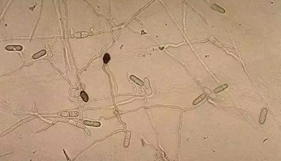 胶孢炭疽菌的形态特征与培养注意事项！