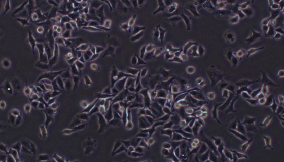 SHP-77人小细胞肺癌细胞的培养步骤与处理方法！