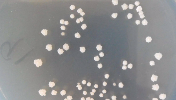 解淀粉芽孢杆菌知识解析及其作为益生菌的应用！ 