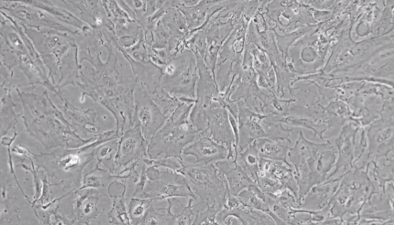 小鼠肾小球系膜细胞永生化原代培养的实验技巧！