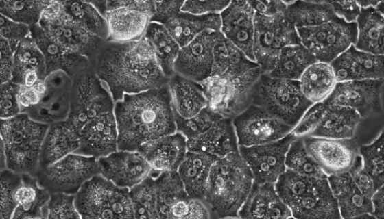 小鼠正常肝细胞接收后的处理方法与培养步骤！