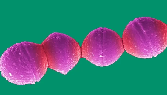 酿脓链球菌的形态特征与培养条件及安全须知！