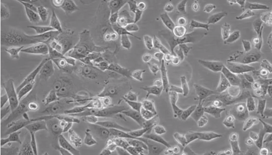 人骨肉瘤细胞的背景与培养步骤及应用！