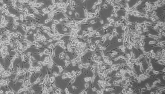 MC38 小鼠结肠癌细胞的处理方法与培养步骤！