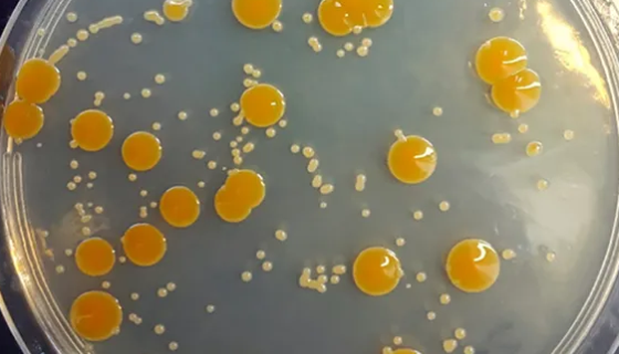 ATCC 29341 盐沼盐杆菌的菌株特点与保藏方法！