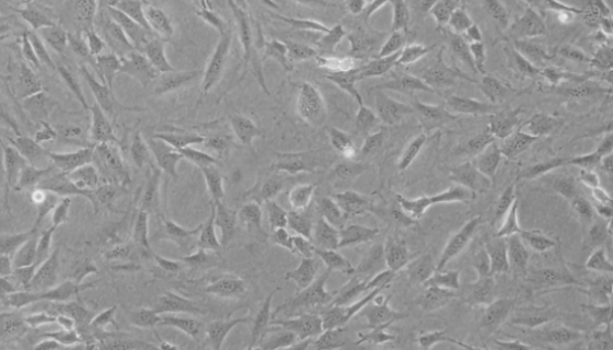 NIH3T3小鼠胚胎成纤维细胞的培养步骤与应用！