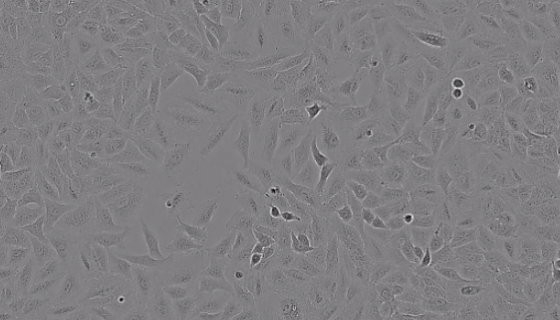 RBL-2H3（大鼠嗜碱性细胞白血病细胞）的应用！