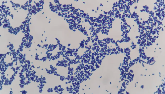 ATCC 49134 表皮葡萄球菌的菌株形态与注意事项！