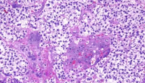 睾丸酮丛毛单胞菌的分离方法及相关研究！