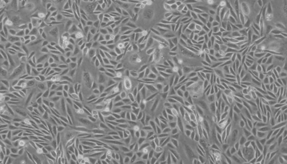 CHO（仓鼠卵巢细胞）的复苏操作要点及注意事项！