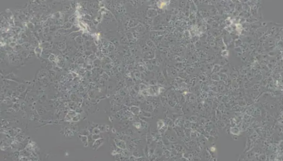 人胎盘绒毛癌细胞的培养步骤与应用！