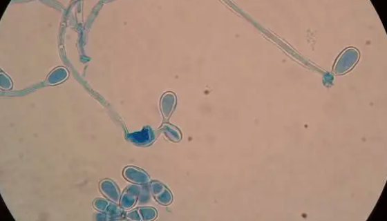 粉红单端孢霉的菌株特点及培养与保存方法！