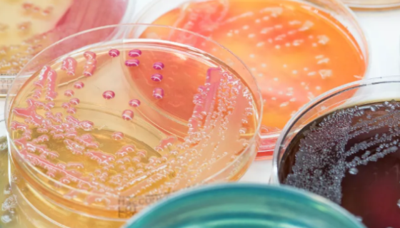 胰化蛋白胨葡萄糖培养基（TGEA）的配制与使用方法！