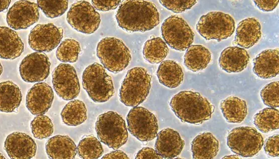 人胰岛β细胞的培养与分离方法及质量检测！