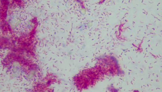 脓肿分枝杆菌的培养条件与注意事项及保藏方法！