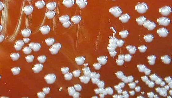 洋葱伯克霍尔德氏菌复合物的鉴定方法及研究进展！