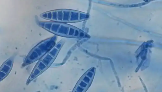 犬小孢子菌的培养特性与鉴别要点及临床意义！