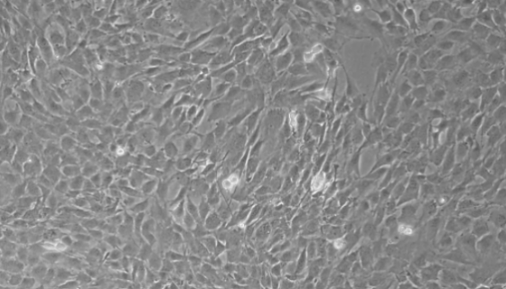 RM-1+LUC 小鼠前列腺癌细胞的处理方法与培养步骤！